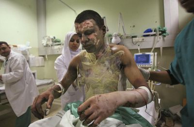 Digunakan untuk Bom Palestina, Ini Dampak Fosfor Putih dan Penggunaannya Pada Tubuh Manusia