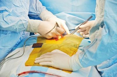 Inilah Pasien Transplantasi Jantung Pertama di Dunia, Bagaimana Nasibnya Sekarang?