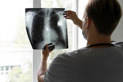Ngeri! Koki Ini Meninggal karena Idap Infeksi Jamur Langka, Paru-paru Rusak bak Keju Swiss