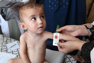 Selain Stunting, Indikasi Wasting Pada Anak Juga Perlu Diwaspadai dan Ditangani Orang Tua