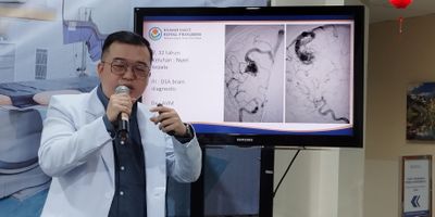 Deteksi Aneurisme di Kepala Lebih Akurat Kini Dapat Dilakukan dengan Teknologi Medis DSA