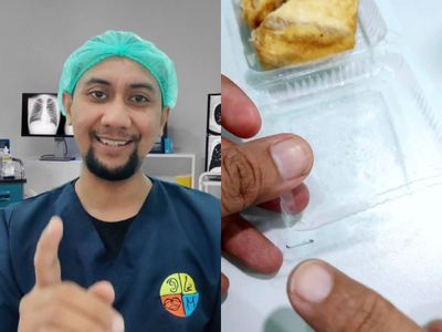 Dokter Ini Ungkap Bahaya Kemasan Makanan Pakai Staples