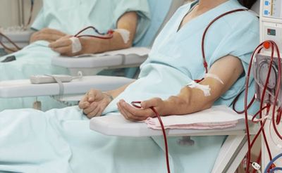 Hipotensi, Kondisi Tekanan Darah yang Tidak Kalah Bahaya dengan Hipertensi