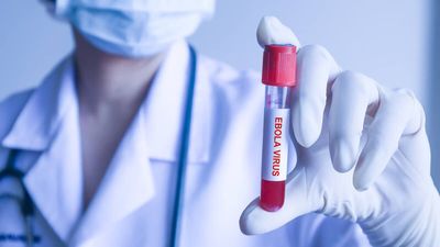 Sejarah dan Karakteristik Penyakit Ebola, Wabah Besar di Afrika Barat pada Tahun 2014-2016