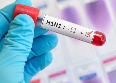 Sejarah Wabah Flu Babi (H1N1) yang Merebak di Seluruh Dunia Tahun 2009