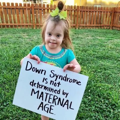 Catat! Inilah 5 Cara Cegah Anak Lahir Down Syndrome