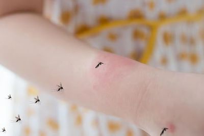 11 Obat Alami Meredakan Gigitan Nyamuk dan Cara Menggunakannya