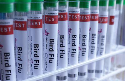 Finlandia Jadi Negara Pertama Lakukan Vaksinasi Flu Burung Pada Manusia