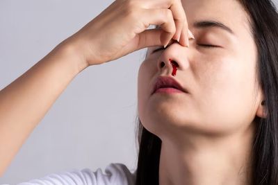 14 Penyebab Mimisan Paling Umum dan Jenisnya