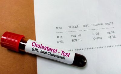 Mitos-mitos tentang Kolesterol yang Masih Sering Dipercaya Banyak Orang