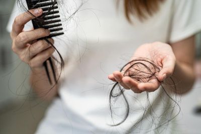Cara Mengetahui Rambut Kekurangan Vitamin dan Solusi Efektif