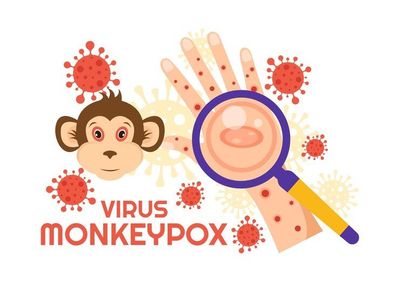 Anak Terkena Mpox, Begini Cara Mengatasinya Jangan Sampai Terlambat