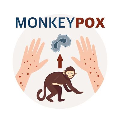 Ketahui Perbedaan Mpox dan Cacar Air, Jangan Sampai Keliru