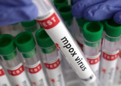 China Laporkan 5 Kasus Varian Baru Mpox, Ini Gejalanya!