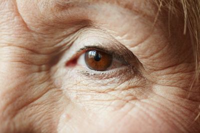 Retinopati Diabetika Rawan Dialami Pasien Diabetes, Penyakit Apa Ini?