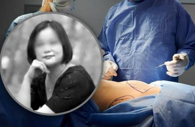 Tragis! Niat Mau Cantik, Wanita Ini Meninggal Usai Jalani 6 Operasi Plastik dalam Waktu Kurang dari 24 Jam