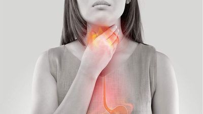 Waspada! Gerd Bisa Jadi Awal Risiko Munculnya Barrett s Esophagus