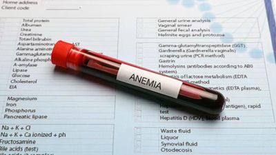 Apakah Donor Darah Bisa Menyebabkan Anemia? Ini Faktanya