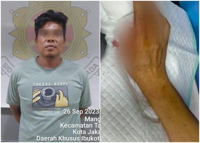Tak Terima Kekasih Digoda dan Dihina, Pria Ini Serang Korban Sampai Jari Putus