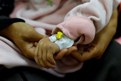 Miris, Rumah Sakit di Gaza Dipenuhi Pasien Anak Kekurangan Gizi Akut