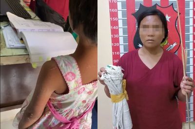 Miris, Bocah Perempuan di Tapteng Dianiaya dan Dimasukkan ke Karung oleh Tantenya