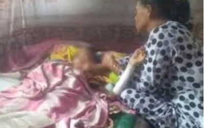 Tragis! Siswi SD Tewas Dibakar Teman di Sekolah, Hingga Meninggal Dunia
