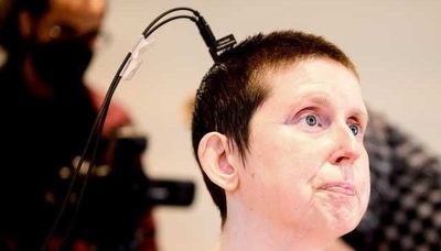 AI Bantu Perempuan yang Kena Stroke Kembali Bisa Berbicara Setelah 18 Tahun