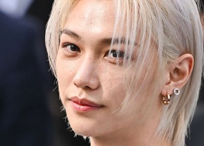 Felix Stray Kids Alami Cedera Patah Tulang Akibat Kecelakaan, Bagaimana Kondisinya?