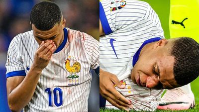 Mbappe Alami Cedera Patah Tulang Hidung Saat Hadapi Austria di Euro 2024