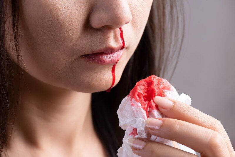 5 Arti Mimpi Mimisan Menurut Primbon Jawa, Apakah Pertanda Buruk?