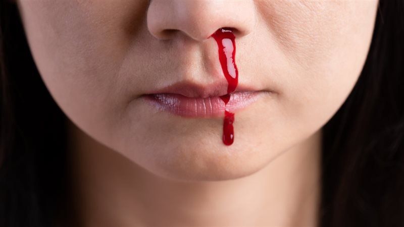 5 Arti Mimpi Mimisan Menurut Primbon Jawa, Apakah Pertanda Buruk?