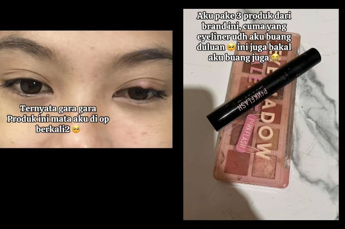 Viral Produk Pinkflash Mengandung Zat Berbahaya, Pengguna Sampai Harus Operasi Mata