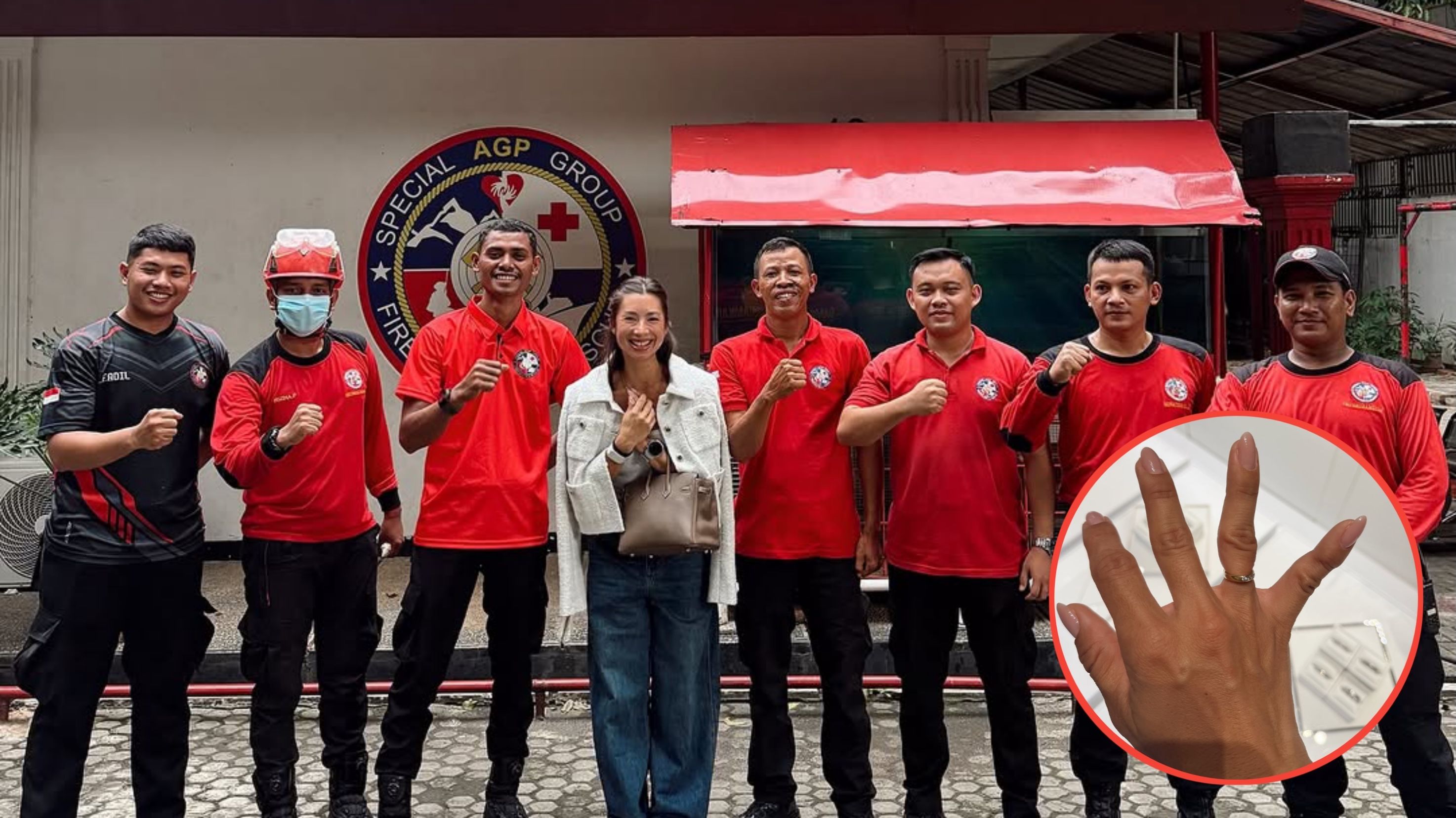 Aduh! Jennifer Bachdim Harus Relakan Cincin Nikahnya Demi Selamatkan Jari