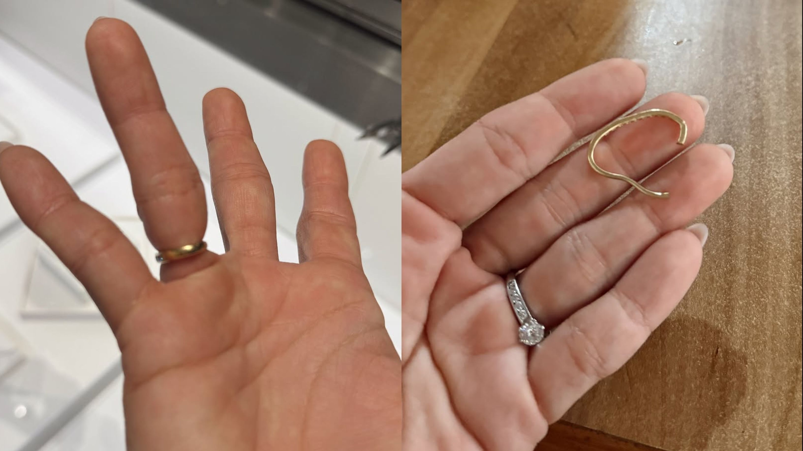 Aduh! Jennifer Bachdim Harus Relakan Cincin Nikahnya Demi Selamatkan Jari
