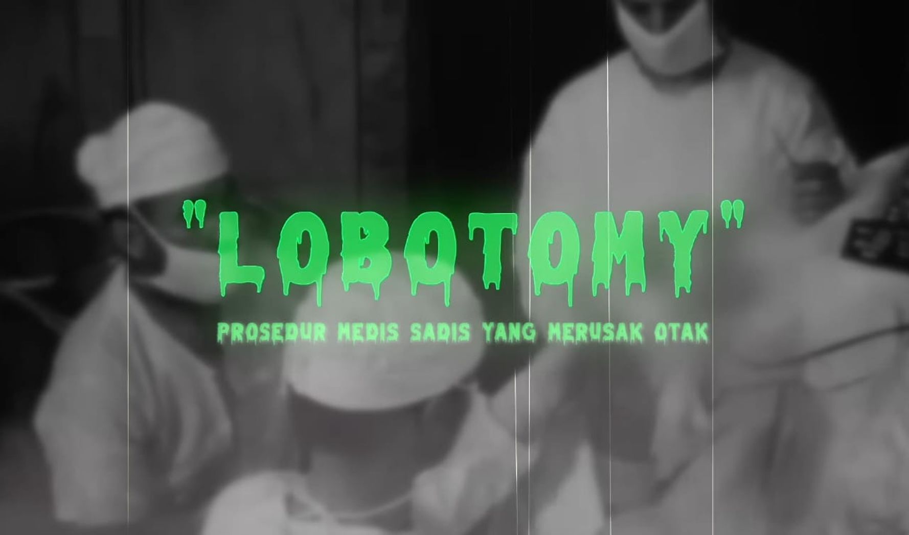 Lobotomi: Operasi Otak Terseram dalam Sejarah Medis Dunia