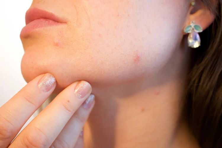 Ternyata Vitamin E Bisa Bikin Jerawatan? Ini Fakta Lengkapnya