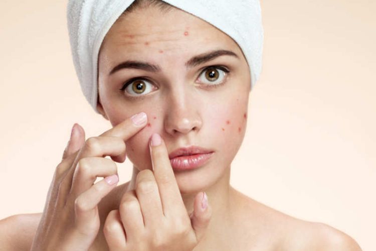 Kulit Kering Tapi Jerawat? Ini 7 Cara Ampuh Mengatasinya Tanpa Merusak Kulit