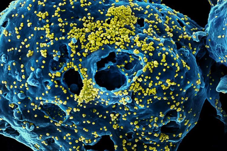 10 Jenis Penyakit yang Disebabkan oleh Virus, Berikut Gejala dan Cara Penularannya