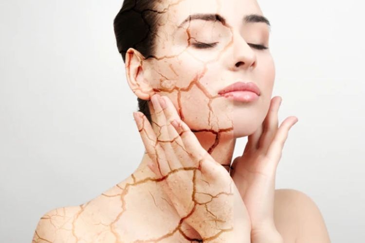 Strategi Para Dermatologis untuk Menenangkan Kulit yang Kering dan Dehidrasi