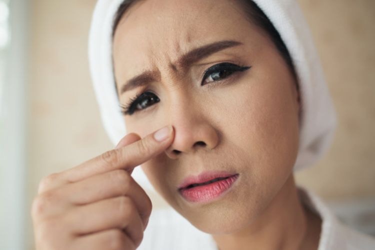 Jerawat Lagi “Matang”? Jangan Dipencet Dulu! Ini Cara Aman Mengatasinya Tanpa Merusak Kulit Wajah