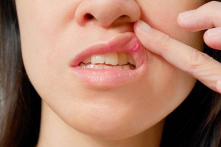 5 Manfaat Getah Daun Jarak untuk Kesehatan yang Perlu Kamu Tahu