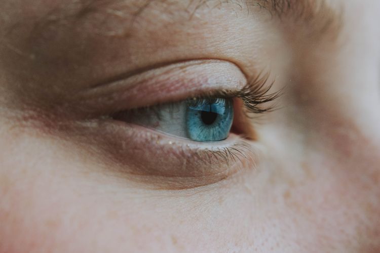 5 Penyebab dan Cara Mengatasi Mata Merah Setelah Pemakaian Softlens