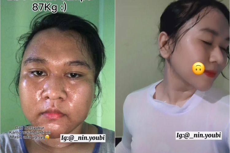 Cewek ini Berhasil Diet ke Berat Badan yang Ideal dan Glow Up, Bikin Netizen Takjub