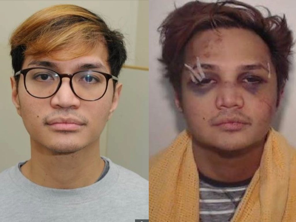 Korban Predator Seks Reynhard Sinaga Mengaku Trauma Berat: Saya Rapuh
