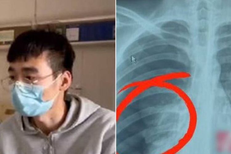 Nyanyi Terlalu Kuat Saat Karaoke, Pria Ini Dilarikan ke RS karena Masalah Paru-paru