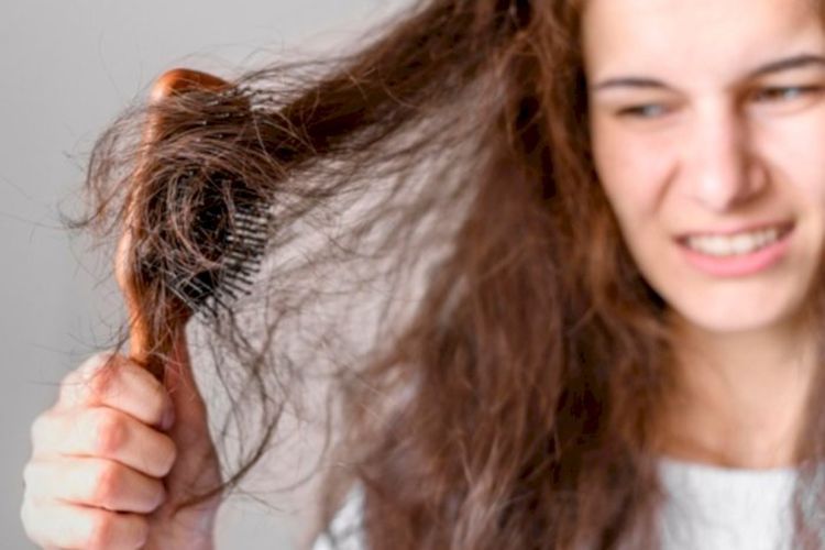 Jangan Stres, Ini 5 Cara Mengatasi Rambut Rontok Parah Mudah Banget