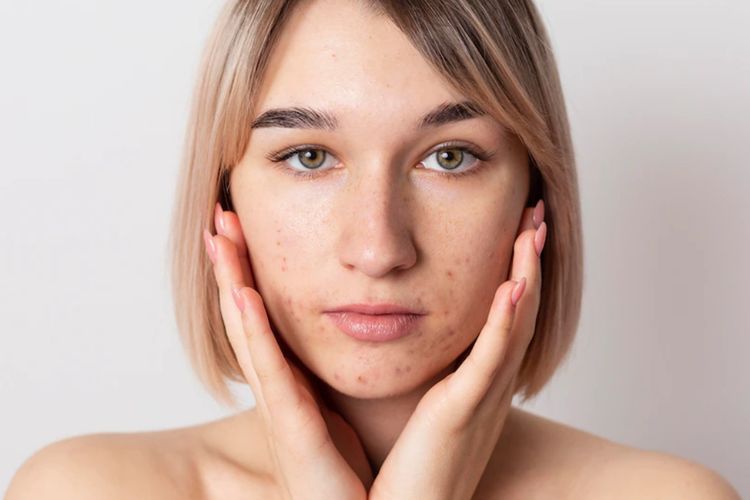 7 Cara Ampuh Merawat Kulit Sensitif, Say Good Bye untuk Kulit Kering dan Iritasi!