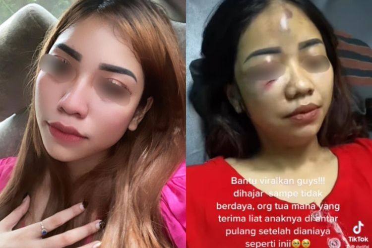 Wajah Perempuan Cantik Ini Babak Belur karena Jadi Korban Kekerasan Kekasihnya