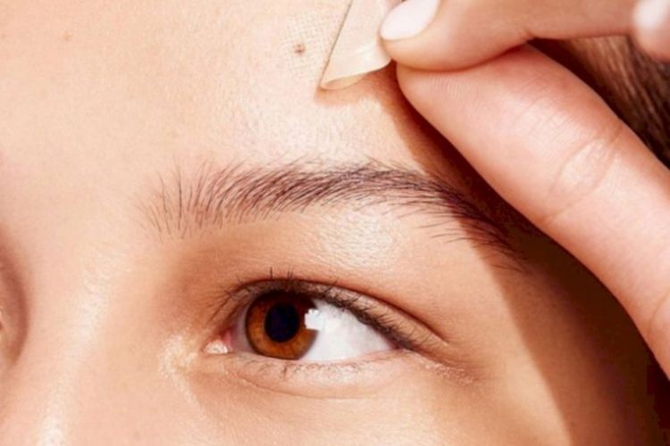 Lagi Digandrungi! Acne Patch Ampuh Hilangkan Jerawat dalam Semalam? Ini Fakta yang Jarang Diketahui!