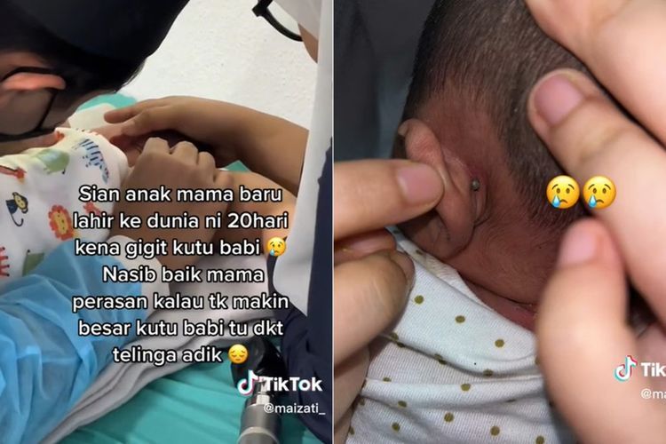 Bayi Usia 20 Hari Nangis Kejer Kupingnya Digigit Kutu Babi, Momen Pencabutannya Dramatis